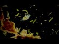 opisthotricha - microorganism under the microscope ...