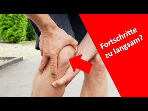 Zu langsame Fortschritte nach Knie-Operation? | Vergleich mit anderen Patienten