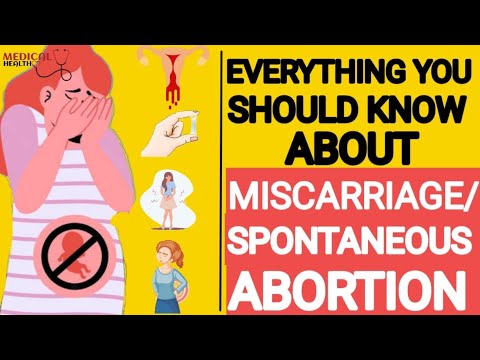 Everything you should know about SPONTANEOUS ABORTION or MISCARRIAGE.