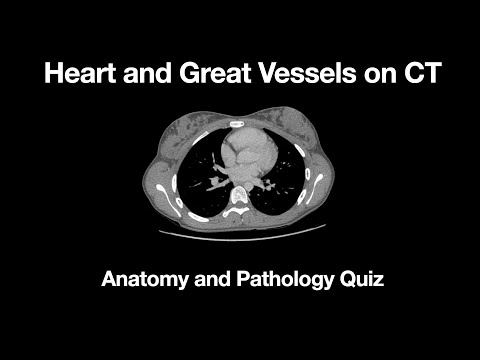 The Heart and Great Vessels Anatomy and Pathology Quiz