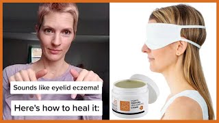 How to Heal Your Eyelid Eczema Naturally