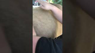 Tapotement clapping, cupping, hacking & beating strokes