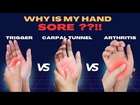 Causes of Hand Pain: Trigger finger vs Carpal tunnel vs Arthritis