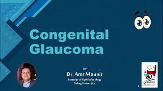 Congenital Glaucoma