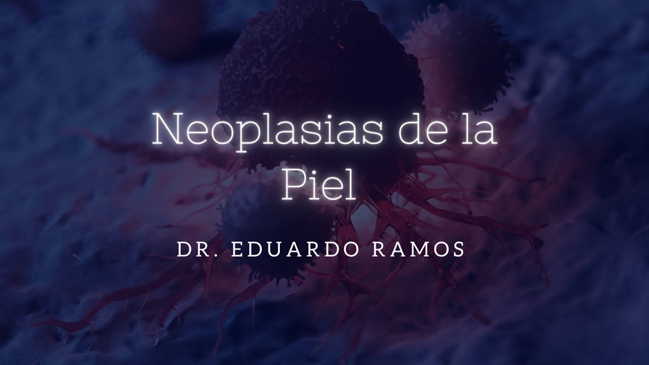 Neoplasias malignas de la piel