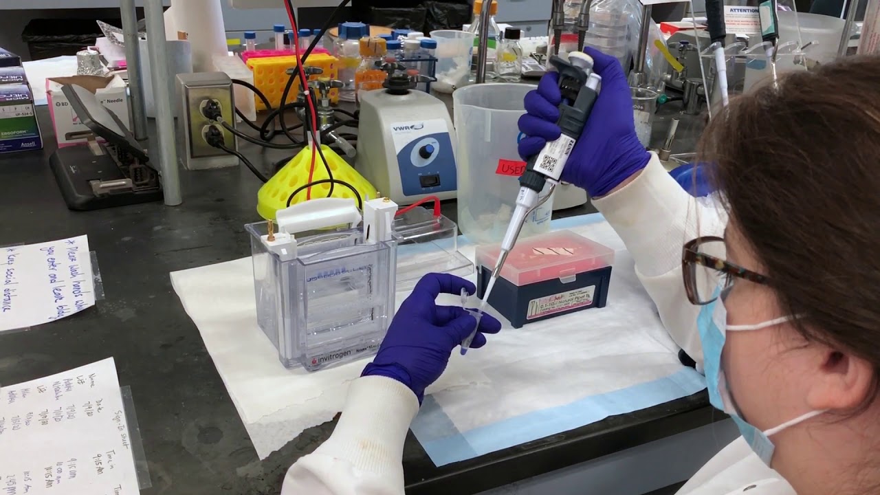 SDS PAGE and Western Blot