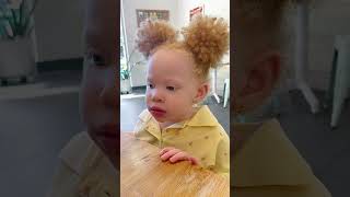 Download lagu What type of #albinism does Zayana have? #albinismawareness #albinismisbeautiful #albino mp3 Download lagu What type of #albinism does Zayana have? #albinismawareness #albinismisbeautiful #albino mp3