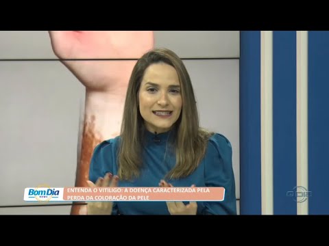 Entenda o Vitiligo: Doença que causa perda da cor da pele 04 07 2022