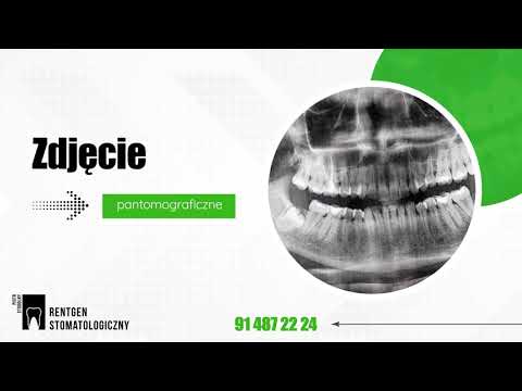 download lagu mp3 mp4 Rtg Szczecin, download lagu Rtg Szczecin gratis, unduh video klip Rtg Szczecin