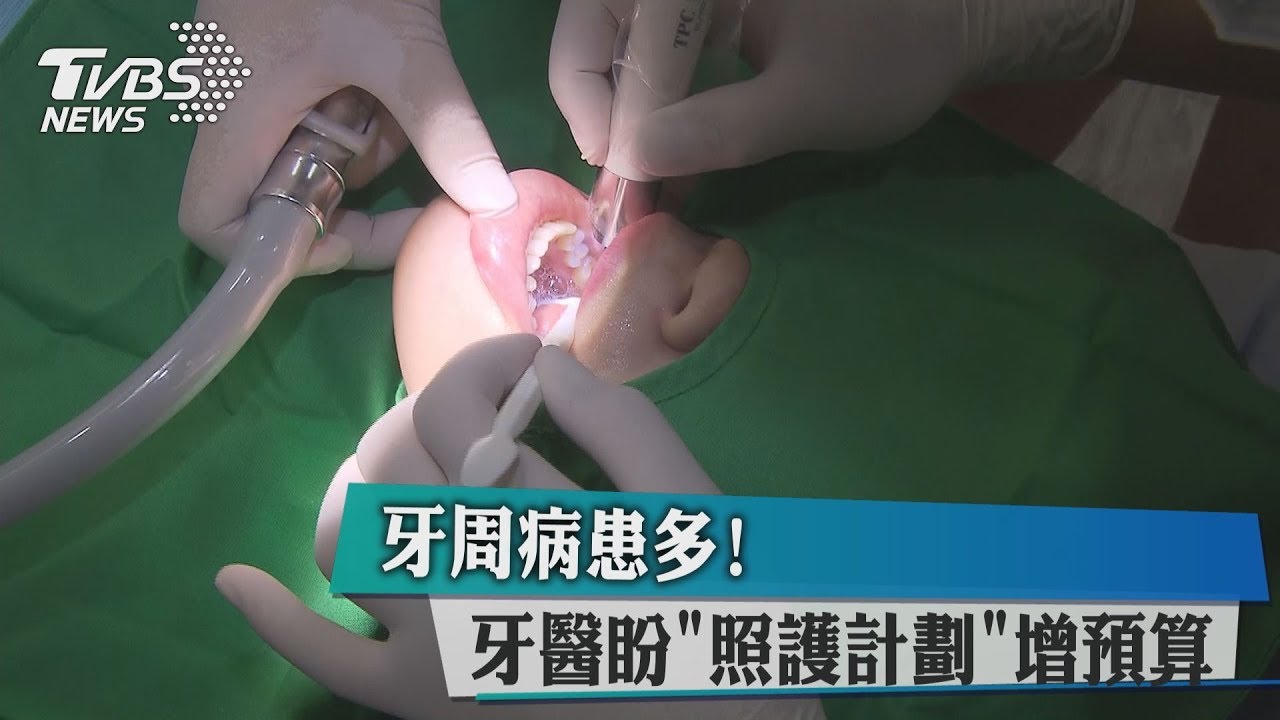 牙周病患多！　牙醫盼「照護計劃」增預算