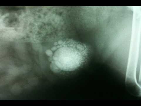 Infected Bladder Psy Mix - DJ Kontol