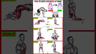 Download lagu FIX Varicocele NATURALLY Today #fitnessworkout001 #varicocele #varicoceletreatment #gym #yoga mp3