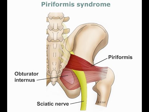 Sciatic Nerve|| Anatomy || Origin || Supply | Course | Divisions | Clinical Aspects