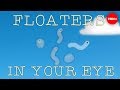 What are those floaty things in your eye? - Michael Mauser