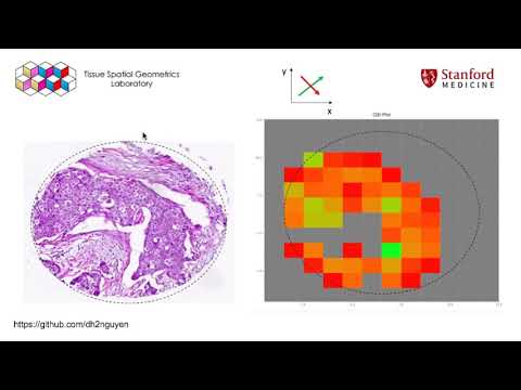Methods for Quantifying Hidden Spatial Information in Tumor Architecture [25 min]
