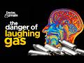 A Teenager Inhaled Laughing Gas For A Year This Is What Happened To His Spinal Cord