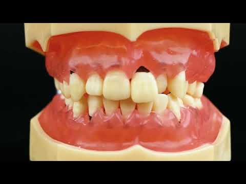 iDENTical Periodontal Model M4003