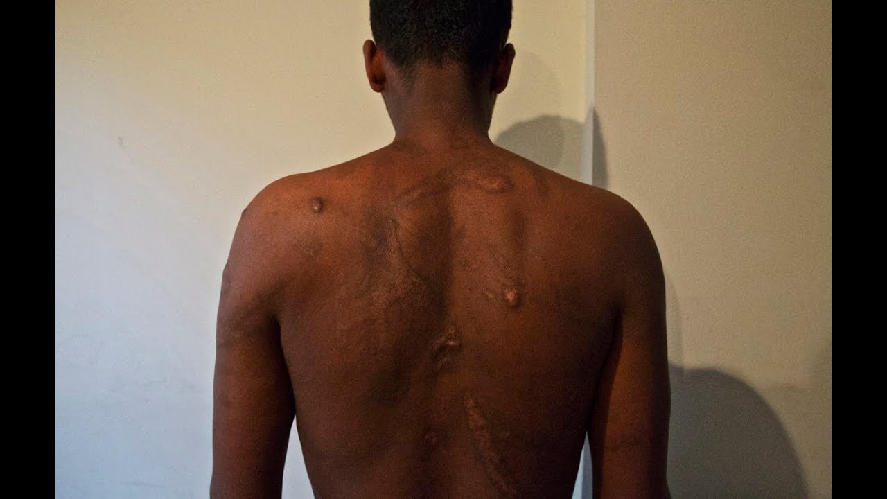 Egypt/Sudan: Traffickers Who Torture