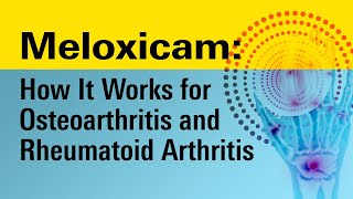 Mastering Meloxicam: Your Essential Guide