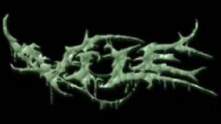 Vile - Surgery