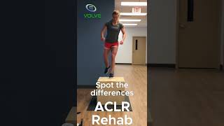Jump Training In ACL Reconstruction Rehab