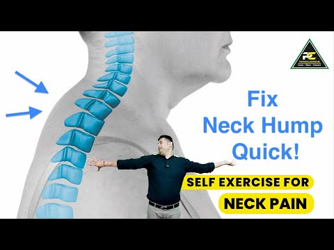 Try this if you have Neck Pain physiotherapy neckpaintreatment
