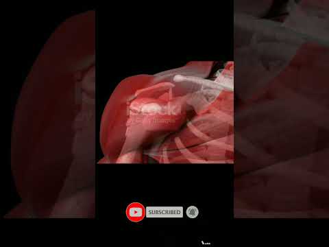 कंधा कैसे अपनी जगह से हट जाता है #medical_classes #shortvideos #orthostatic #viralvideo #official