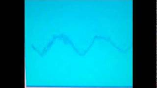 terrance dixon - what up.flv