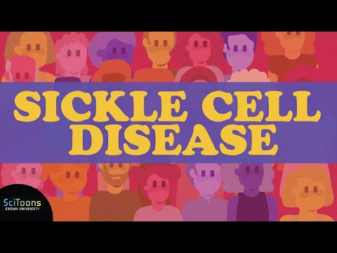 Sickle Cell Disease (SCD): A Neglected Global Health Burden