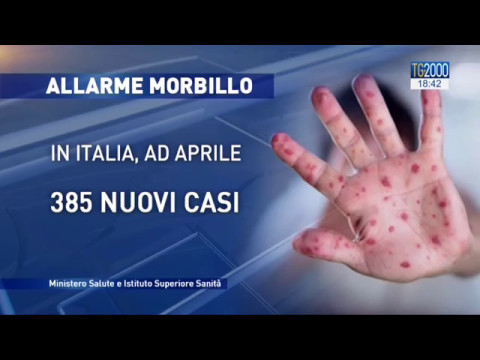 Allarme morbillo: l'intervista a Walter Ricciardi