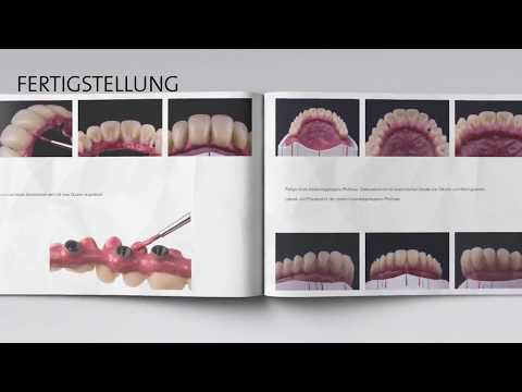 KZW 2017 - Beste Dokumentation