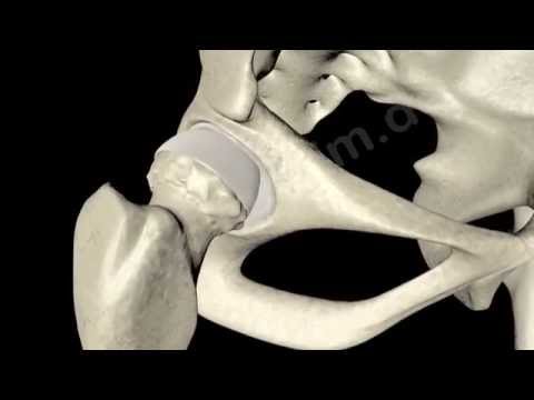 Das Hüftgelenk