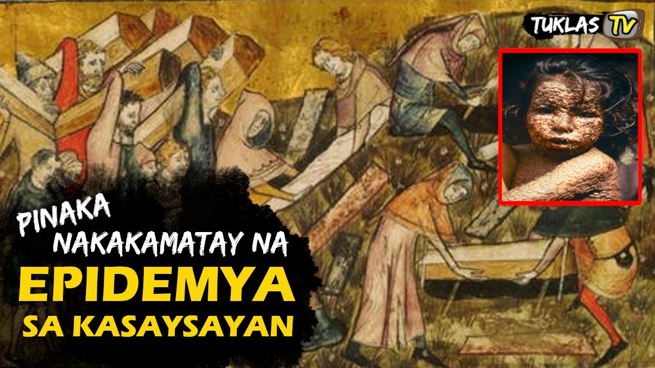 Putar video 10 PINAKA NAKAKAMATAY NA EPIDEMYA SA KASAYSAYAN | 10 DEADLIEST EPIDEMICS IN HISTORY | TTV HISTORY sekarang 10 PINAKA NAKAKAMATAY NA EPIDEMYA SA KASAYSAYAN | 10 DEADLIEST EPIDEMICS IN HISTORY | TTV HISTORY