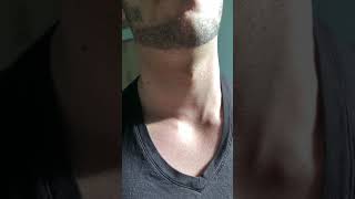 My visible neck pulse