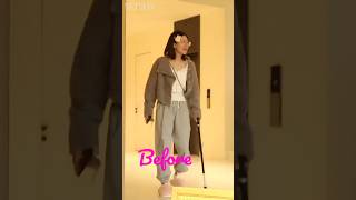 Download lagu Zhao Lusi Before vs Now | Health Condition 💫🥰 mp3 Download lagu Zhao Lusi Before vs Now | Health Condition 💫🥰 mp3