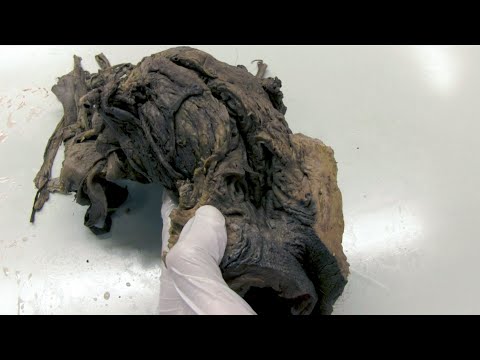 2 Fragen 1 Organ - Rektum