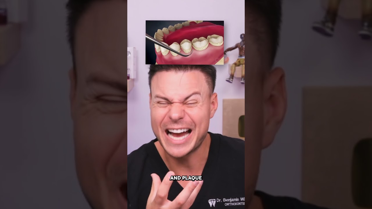 Dentist Reveals The Truth About CAVITIES! 😮🦷