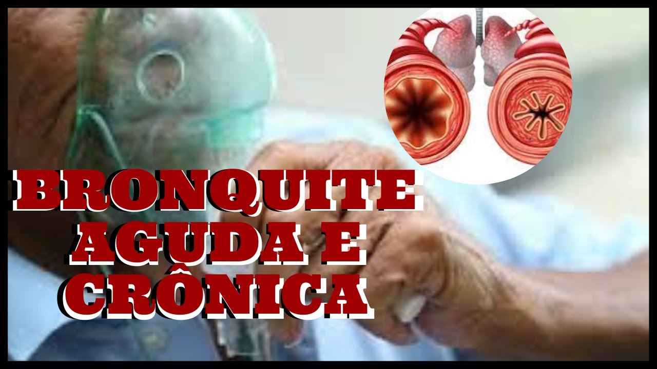 ENTENDA O QUE É BRONQUITE AGUDA E CRÔNICA