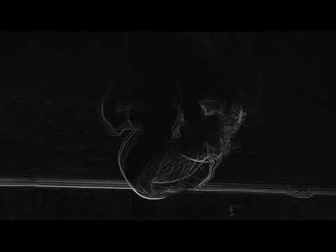 Redencion - 03 ANSIE (Provimiento)