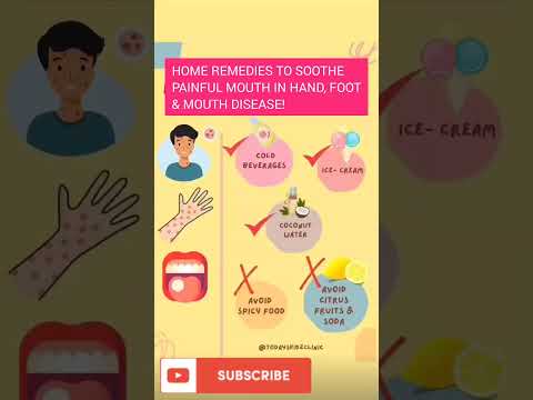 Hand, foot & mouth disease home remedies #kidshealth #paediatrician