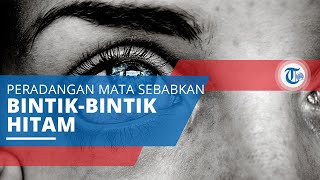 Iridosiklitis, Penyakit Peradangan Mata Menyebabkan Mata Mengeluarkan Bintik-bintik Hitam