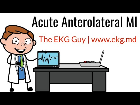 Acute Anterolateral MI on EKG / ECG l The EKG Guy - www.ekg.md