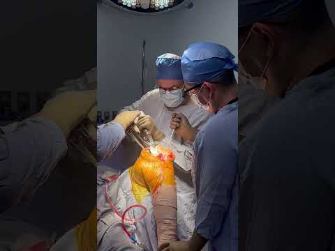 Israel Romo Aguilera-26