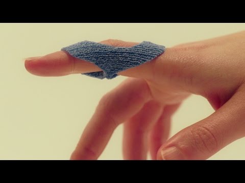 Anti-swan neck orthosis (pinch method) - Orficast Instructional Movie 5