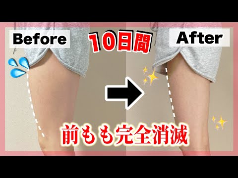 前ももをゆるめる太ももラインケア プレビュー