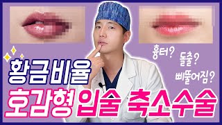 [입술 성형] 입술 축소 무작정 줄이고 제거하는 것이 아니다! 가지고 있는 입술 고민 여기 있네❤