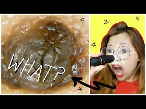 Ang isang malusog na diyeta para sa isang malusog na diyeta Hoop hoop-hoop pagbaba ng timbang mga review