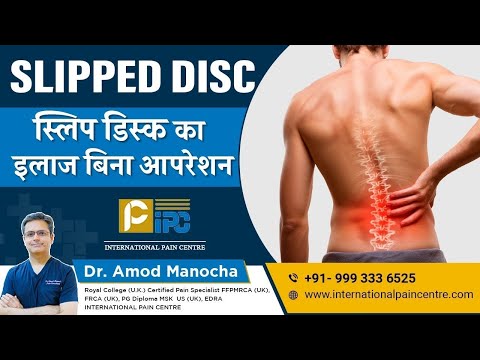SLIPPED DISC Treatment Without Surgery