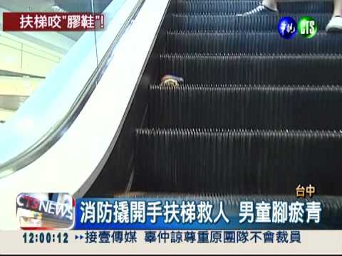 手扶梯"咬人"! 2歲童右腳瘀青