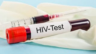 Infectia HIV a fost invinsa de celulele stem!